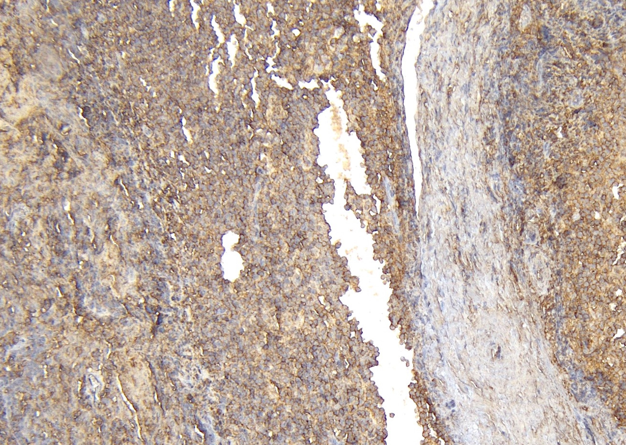IHC