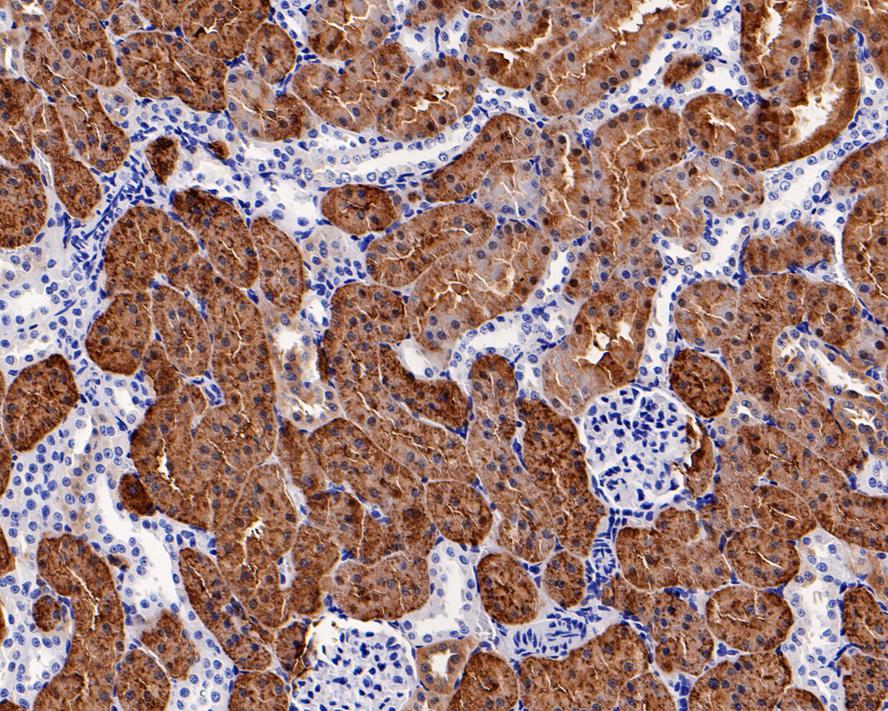 IHC