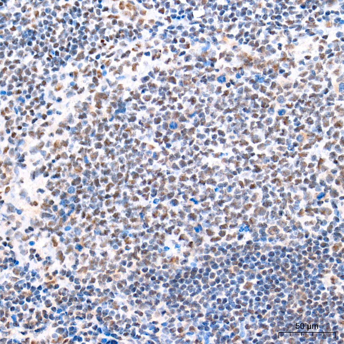 IHC