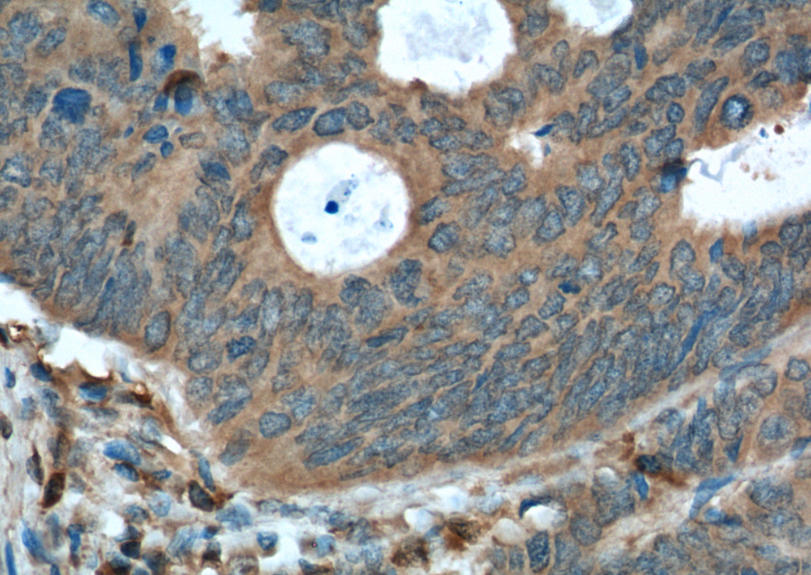 IHC