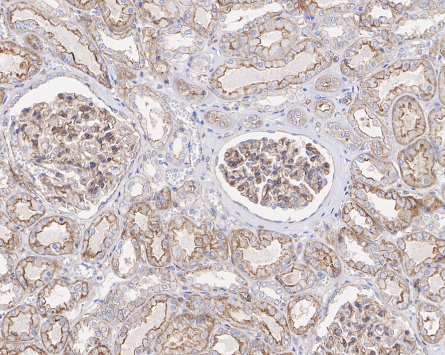 IHC