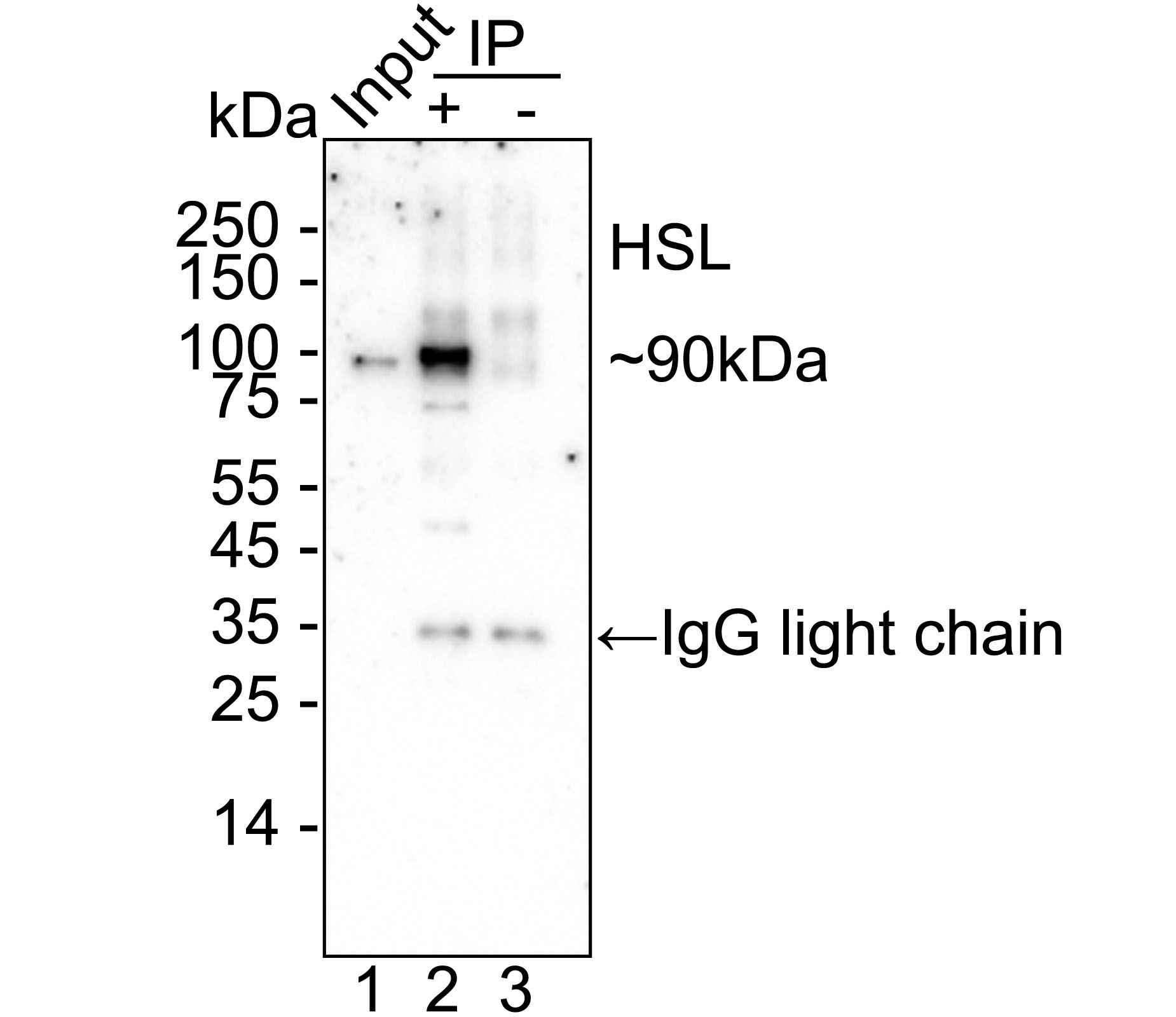 Hormone sensitive lipase / HSL Recombinant Rabbit Monoclonal Antibody ...