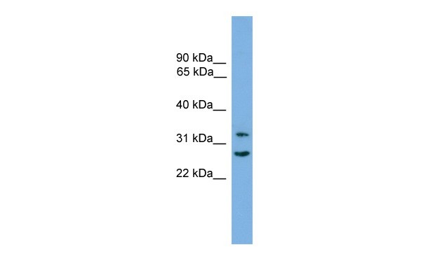 		Western blot