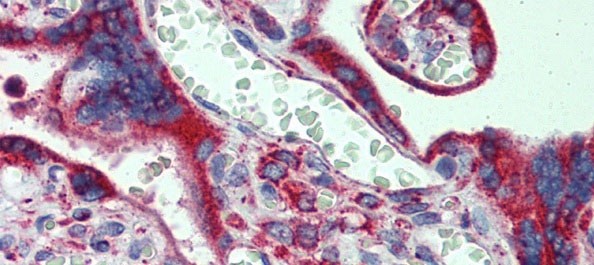 		Immunohistochemistry