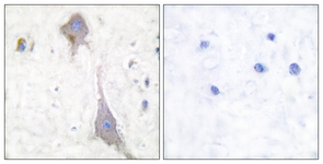 		Immunohistochemical