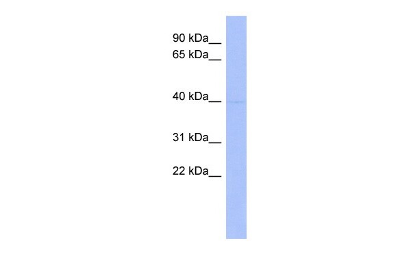Western blot