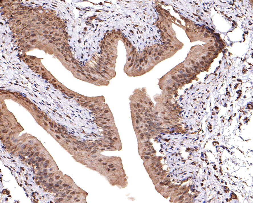 IHC