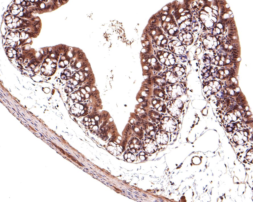 IHC