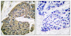 		Immunohistochemical