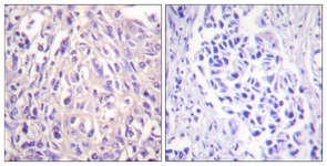 		Immunohistochemical