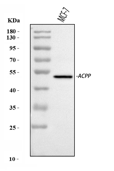 Acp3 Rdc Rabbit polyclonal antibody to ACPP/ACP3 - Omnimabs