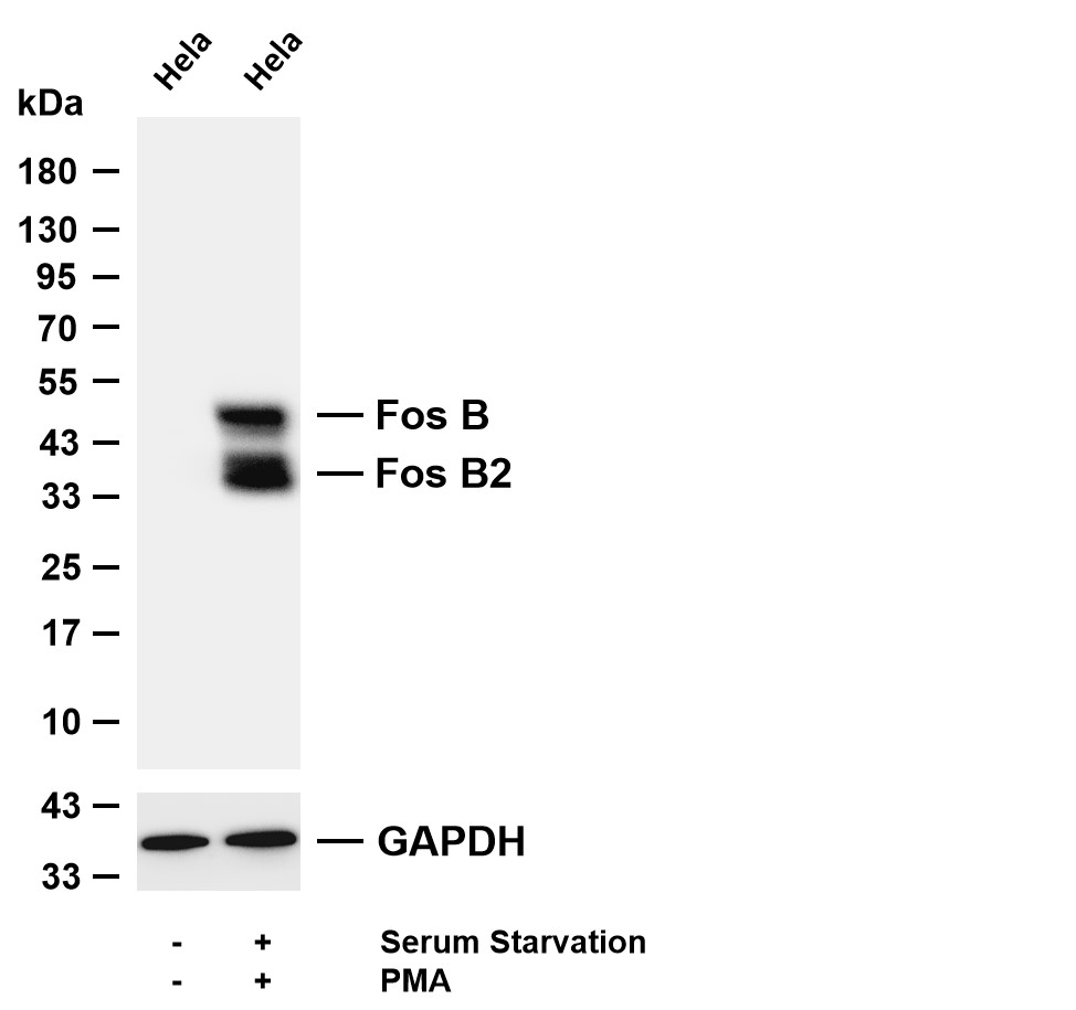 Fos B Rabbit mAb - Omnimabs