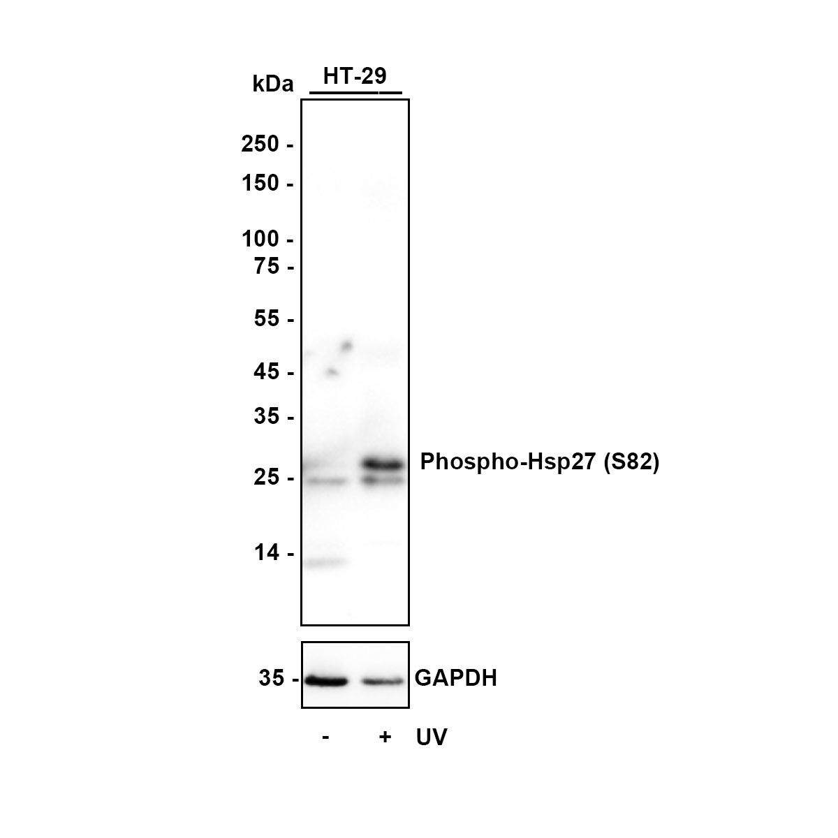 Rabbit S82 Phospho-Hsp27 (S82) Recombinant Rabbit Monoclonal Antibody - Omnimabs