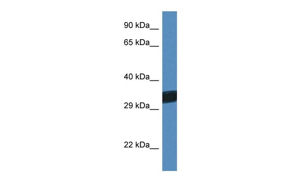 		Western blot