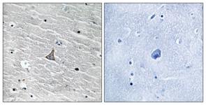 		Immunohistochemical