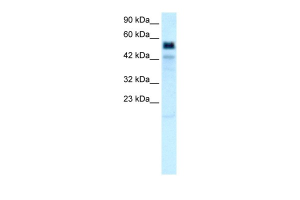 Western blot