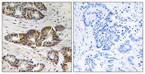 		Immunohistochemical