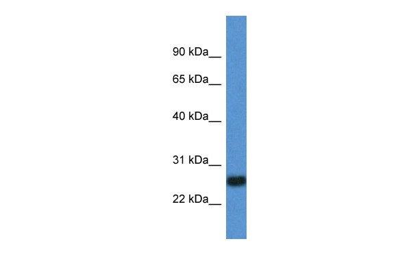 		Western blot