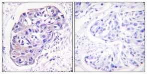 		Immunohistochemical