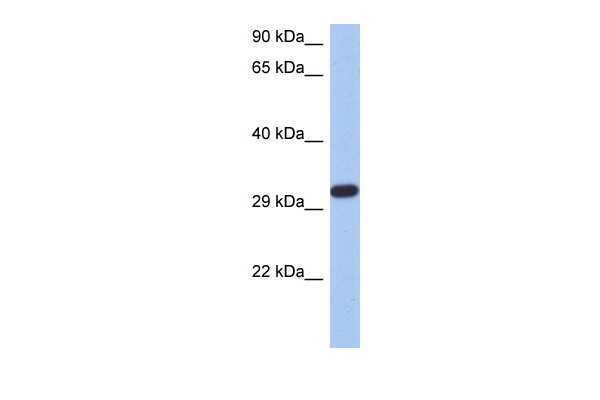		Western blot