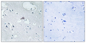 		Immunohistochemical