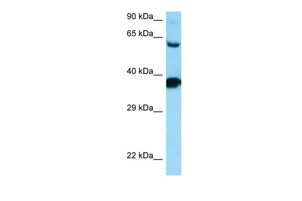 		Western blot