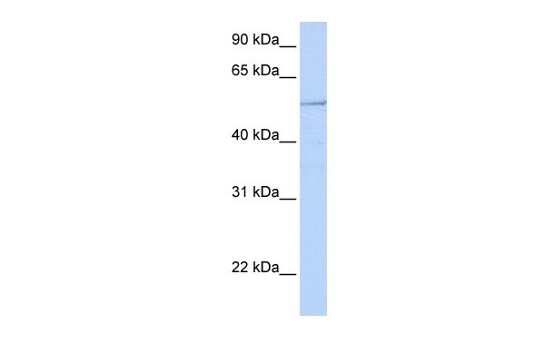 Western blot