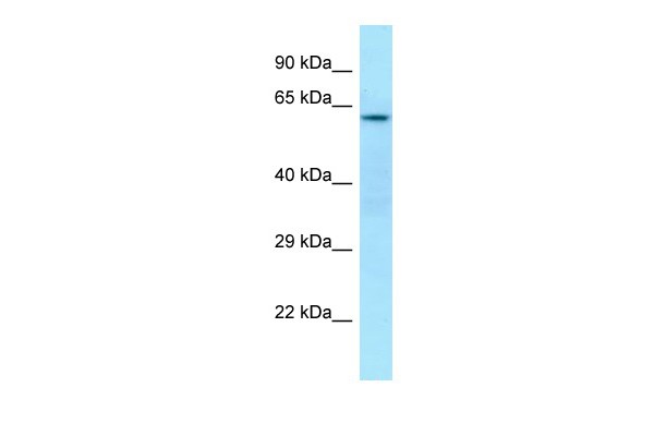 		Western blot