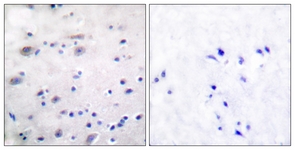 		Immunohistochemical