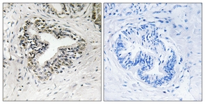 		Immunohistochemical