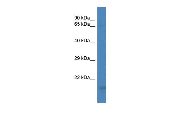 		Western blot