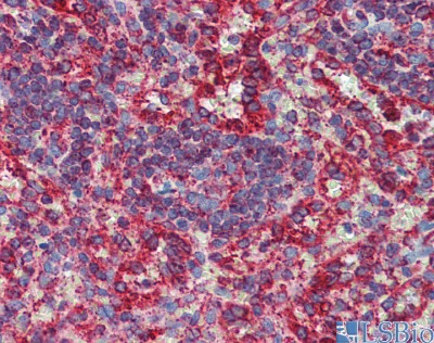 		Immunohistochemistry