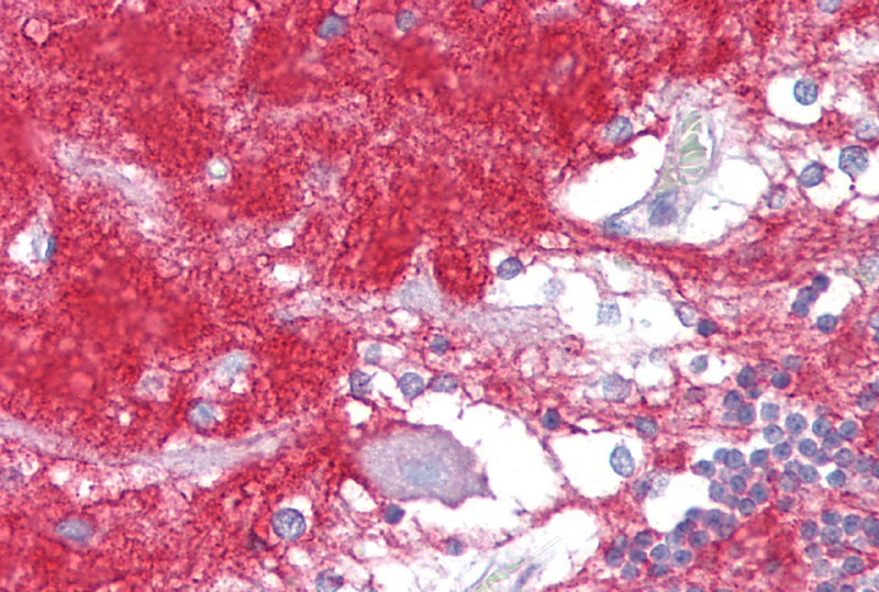		Immunohistochemistry