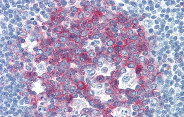 		Immunohistochemistry
