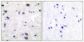 		Immunohistochemical