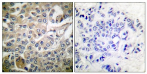 		Immunohistochemical