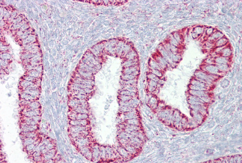 		Immunohistochemistry